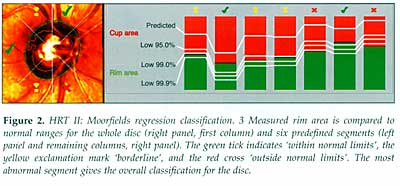 Fig.2 Moorfield's regression classification