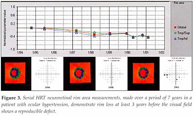 Fig. 3 - serial HRT neuroretinal rim area measurements